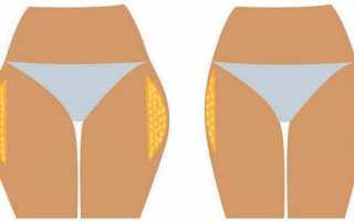Как убрать ушки на бедрах и уменьшить объем ног: топ 16 упражнений