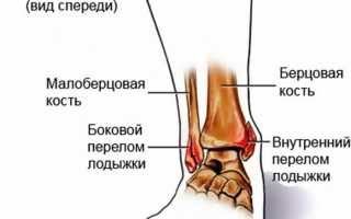 Удаление металлоконструкций (спиц, пластин, винтов) после ранее проведенных оперативных вмешательств