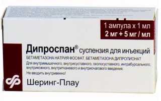 Уколы в пятку при назначенной блокаде пяточной шпоры