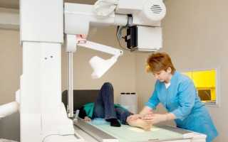 Показания к проведению рентгена голеностопного сустава, противопоказания, расшифровка, диагностическая ценность и другие методы диагностики