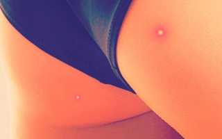 Как избавиться от целлюлита на ягодицах в домашних условиях: 10 способов