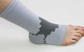 Применение бандажа при растяжении связок голеностопа