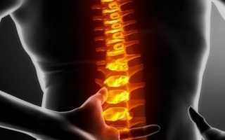 Рак спинного мозга: симптомы, причины и методы лечения опасного заболевания