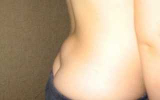 Что такое трабекулярный и субхондральный отек тела позвонка