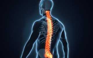 Осложнения при переломах остистого отростка позвонков