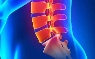 Что такое ретролистез l5 позвонка и каковы причины появления патологии
