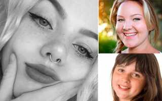 Как быстро похудеть в лице, чтобы появились скулы и впали щеки?