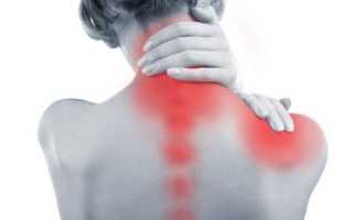 Постизометрическая релаксация при плечелопаточном периартрите