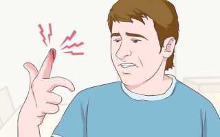 Отекают руки по утрам: причины и что делать