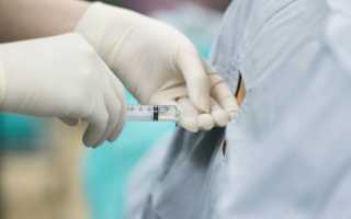 Что такое блокада в медицине? Зачем делают блокаду? Какие препараты применяют при блокаде