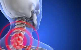 Остеохондроз: обезболивающие препараты и антидепресанты