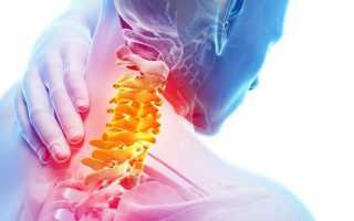 Болят мышцы шеи (сбоку, сзади, с воротниковой зоны): лечение, что делать