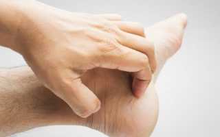 Что делать если чешутся и зудят ноги выше колена с внутренней стороны: причины, диагностика и лечение