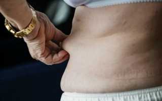 Почему жир на животе самый опасный для здоровья?