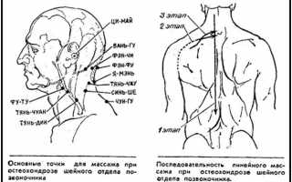 Применение точечного массажа при шейном остеохондрозе
