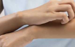 Болезненность кожи при прикосновении на бедре: возможные причины и лечение