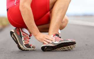 Растяжение связок голеностопного сустава — лечение в домашних условиях