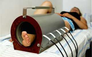 Использование физиотерапии для комплексного лечения переломов