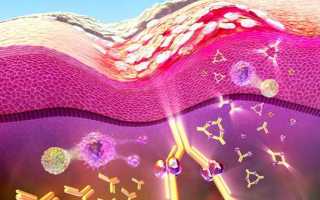 Моноклональные антитела: обзор препаратов, применение для лечения