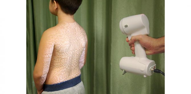 3d-корсетирование