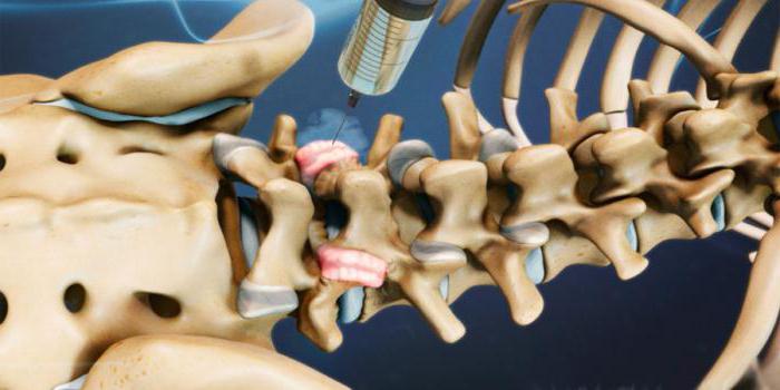 блокада ножек пучка гиса