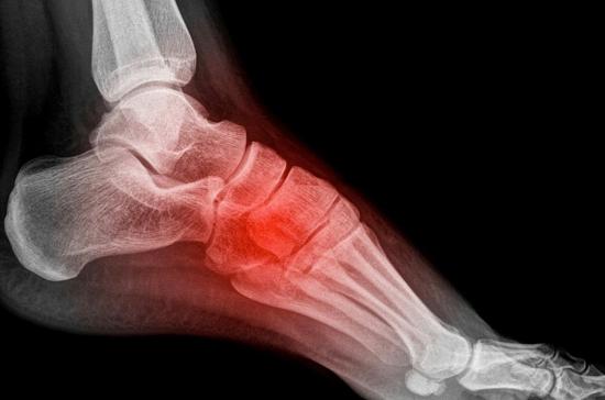 боль в стопе