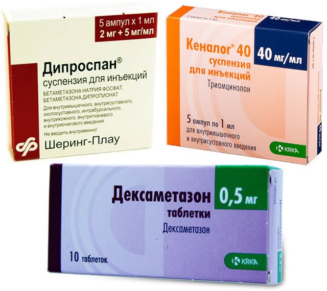 дипроспан, дексаметазон и кеналог