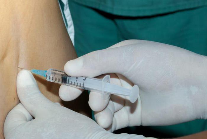 эпидуральная блокада