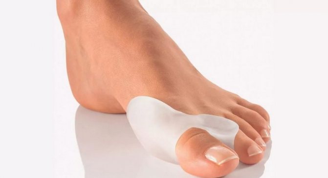 Фиксаторы для большого пальца стопы