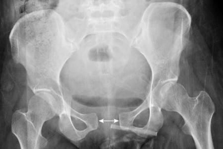 Как диагностировать патологические изменения фото