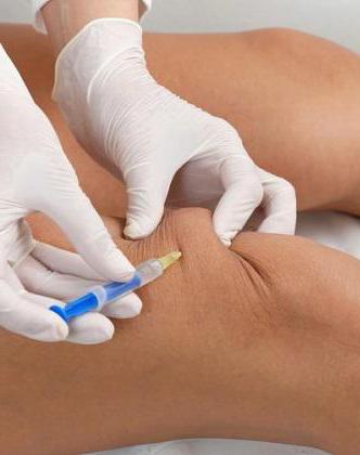 какие препараты применяют при блокаде