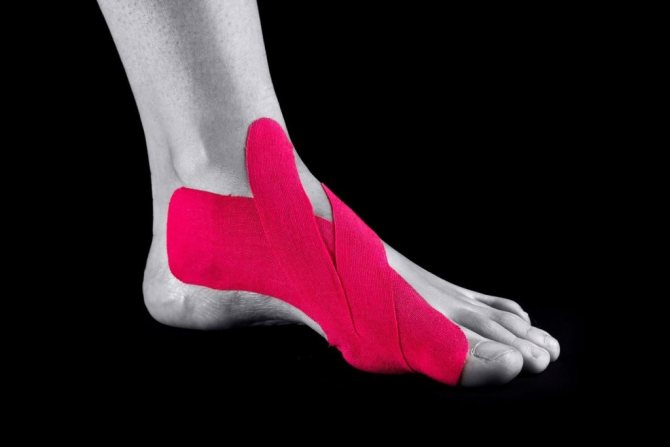 Косточка на большом пальце стопы