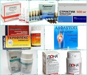 Медикаменты помогают снизить воспалительные процессы и болевые ощущения при дорсопатии