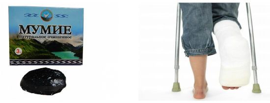 Мумие, перелом ноги