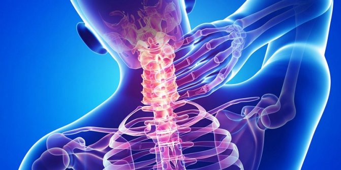 Нестабильностью шейного отдела позвоночника симптомы и лечение