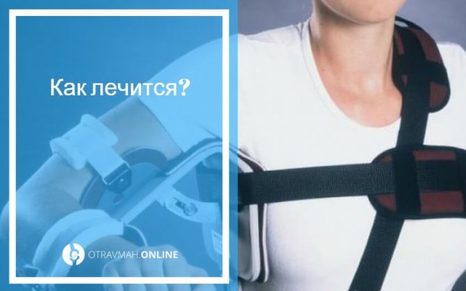 перелом бугорка плечевой кости лечение