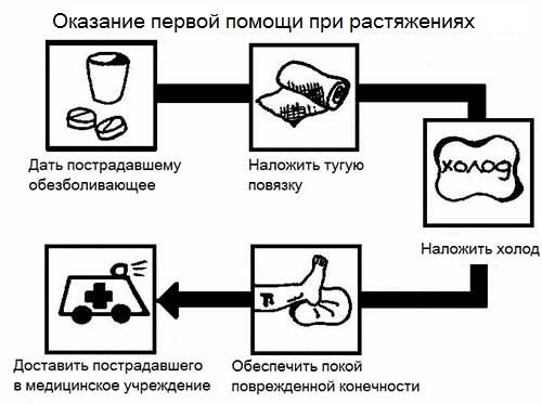 первая помощь при растяжениях