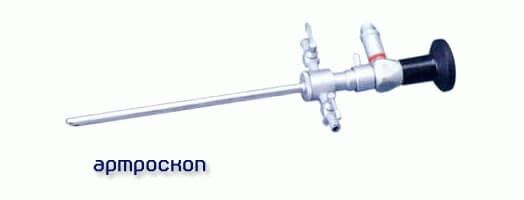 Повреждение медиопателлярной складки коленного сустава