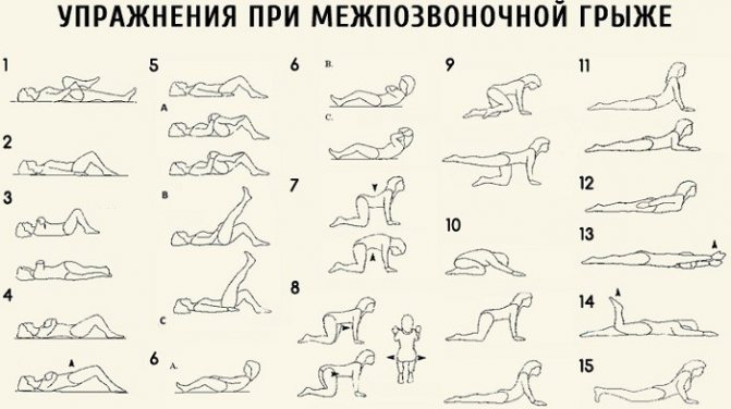 При грыже грудного отдела позвоночника к какому врачу