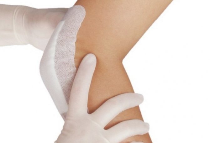 Прикладываем компресс на локтевой сустав