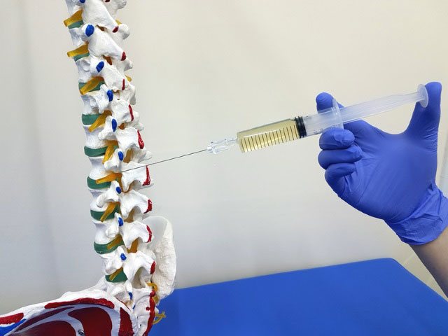 проведение блокады на макете позвоночника