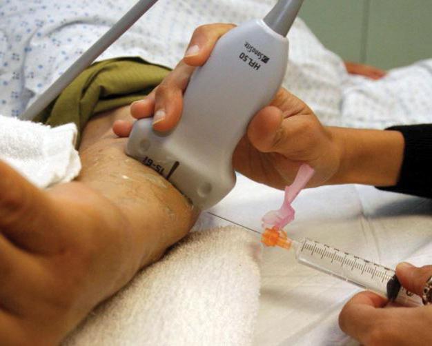 проведение паравертебральных блокад