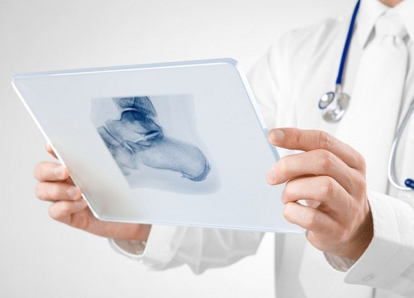 Расшифровка результатов рентгена