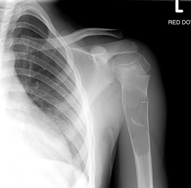 рентгеновский снимок