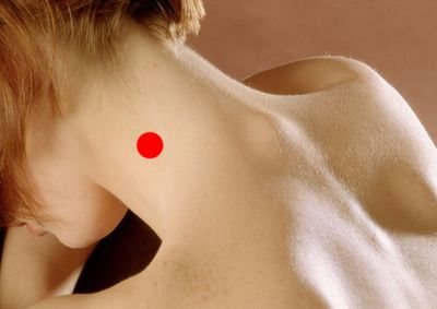 Шишка на позвоночнике в поясничном отделе