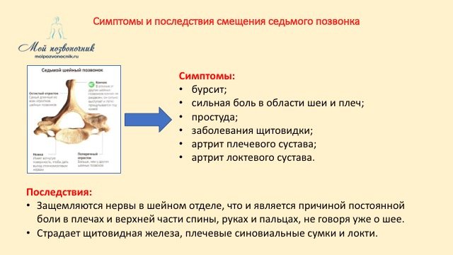 Симптомы смещения седьмого