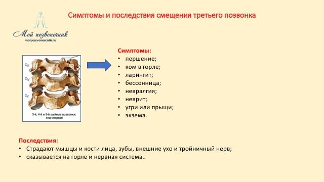 Симптомы третьего