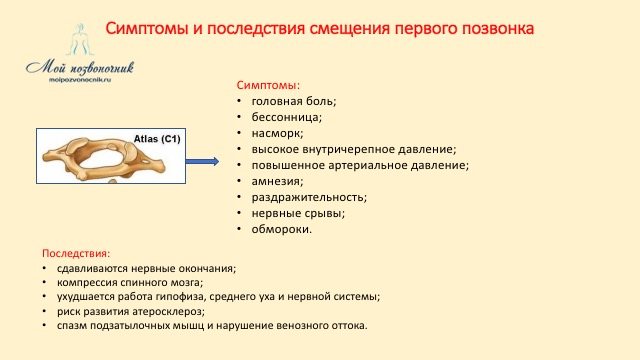 Смещение первого шейного позвонка