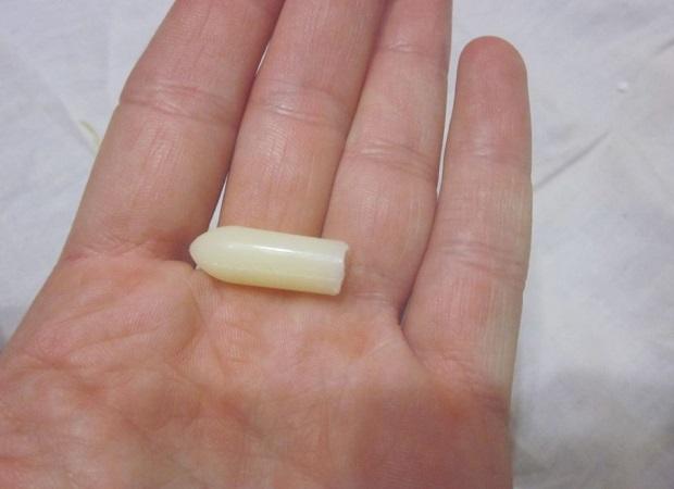 Свечи Вольтарен в гинекологии