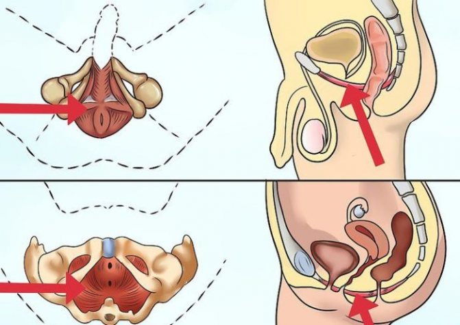 тазовое дно